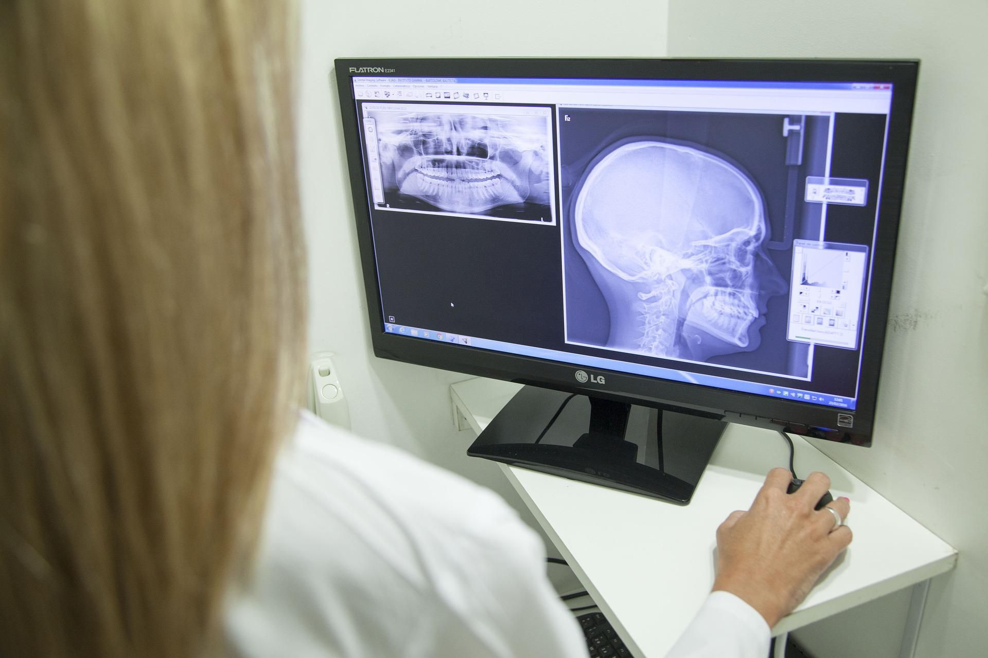 đ©ââïž EU godkĂ€nner automatisk AI-analys av röntgenbilder