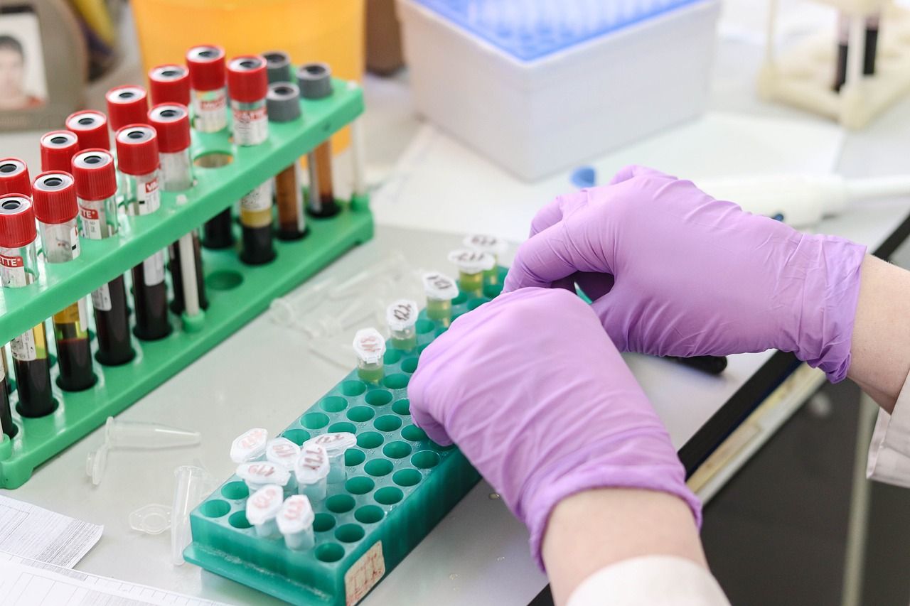 đ§Ș Ny metod kan upptĂ€cka mĂ„nga cancerformer med ett enda test