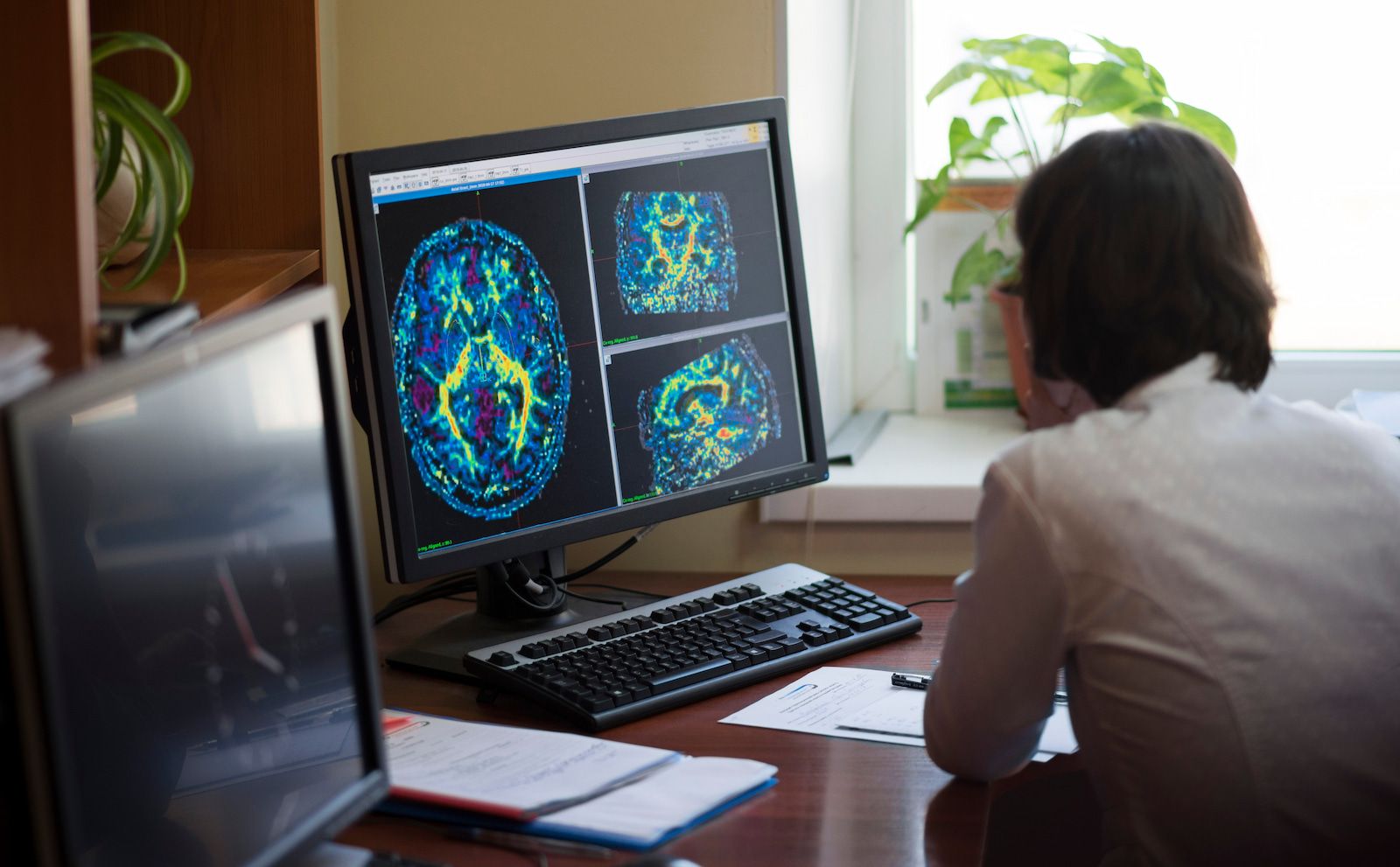 đ§ Skarpaste bilden nĂ„gonsin av en hjĂ€rna