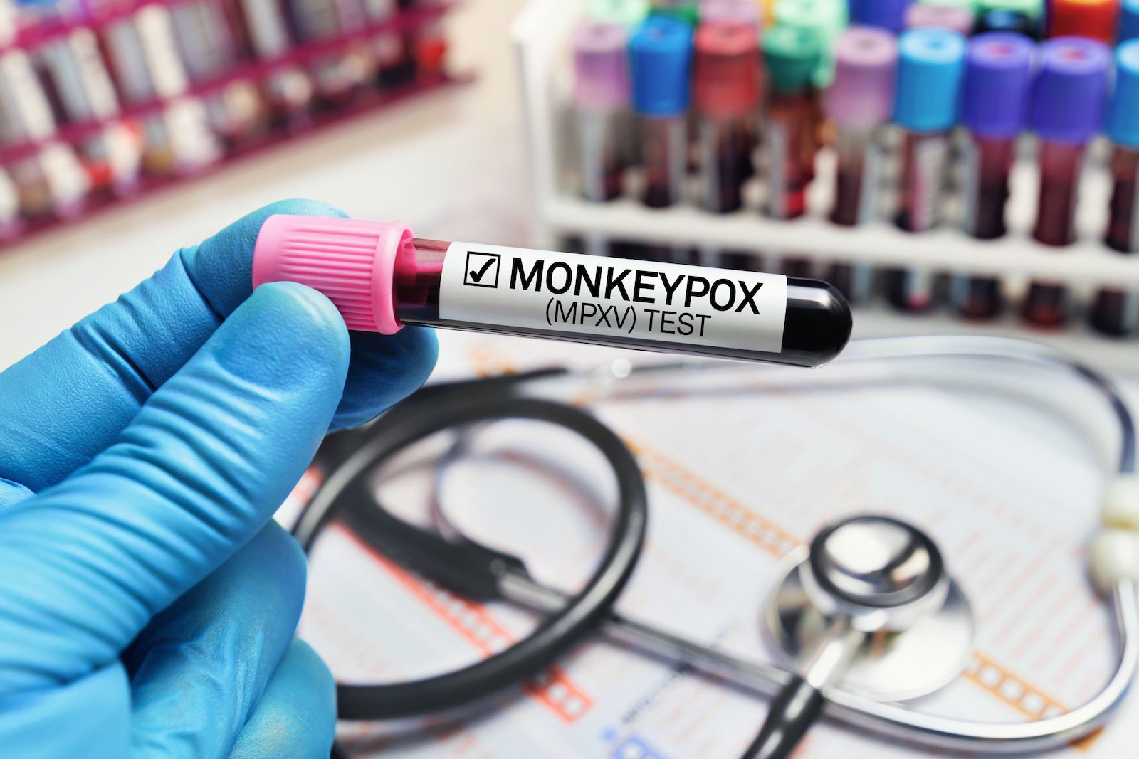 đ Apkoppor (monkeypox) inte lĂ€ngre globalt nödlĂ€ge