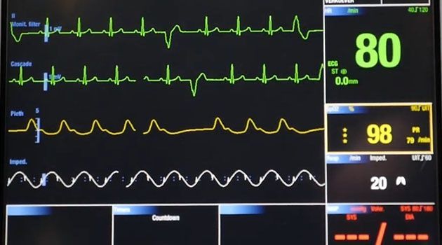 ❤ AI kan avlasta hjärtspecialister genom att automatiskt analysera EKG