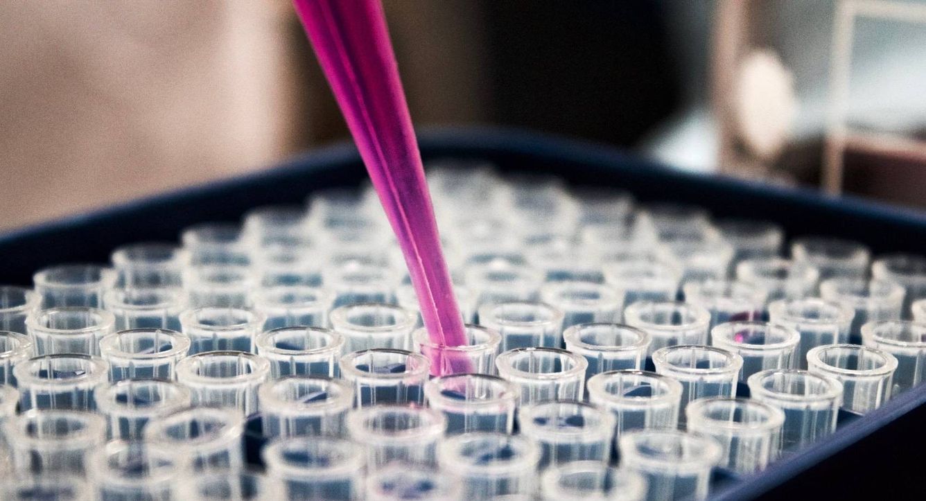 🧫 Ny metod kan hitta cancerceller innan de skapar tumörer