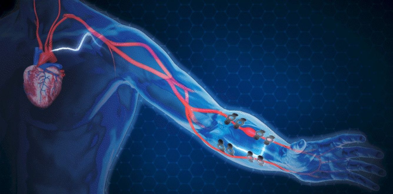 🩺 E-tatuering håller koll på ditt blodtryck