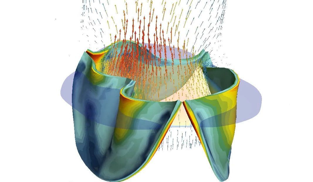 💖 Visualisering ska ge bättre och säkrare hjärtoperationer