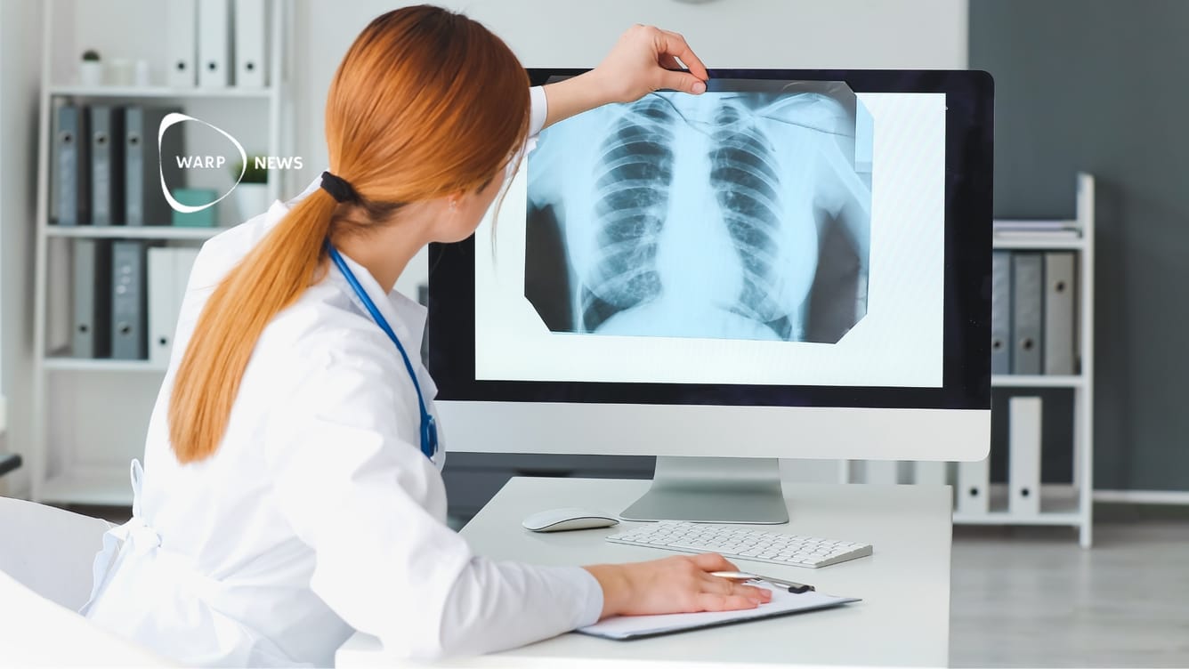 👩‍⚕️ Tuberkulos minskar stadigt